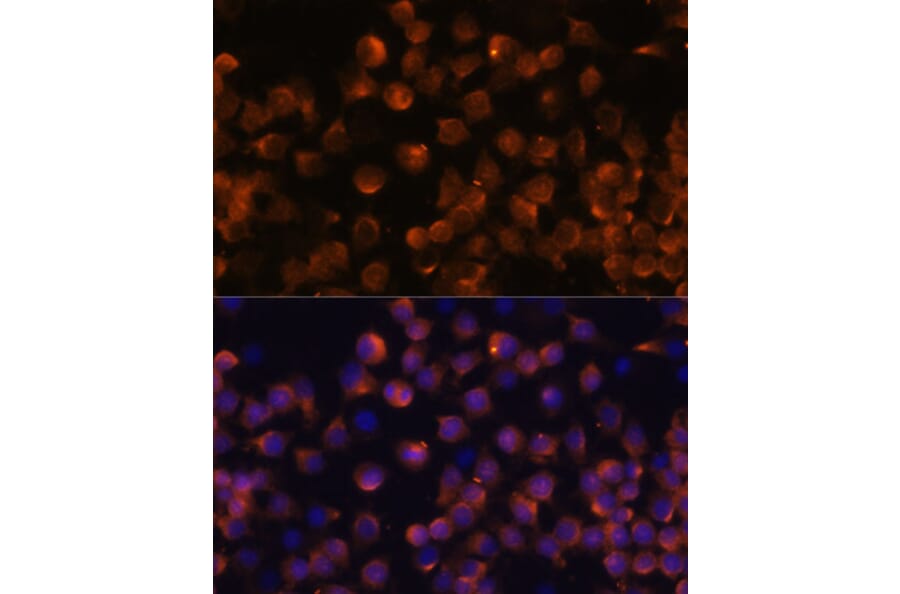Immunofluorescence - Anti-Complement factor B Antibody (A13606) - Antibodies.com