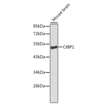 Western Blot - Anti-CtBP1 Antibody (A13607) - Antibodies.com