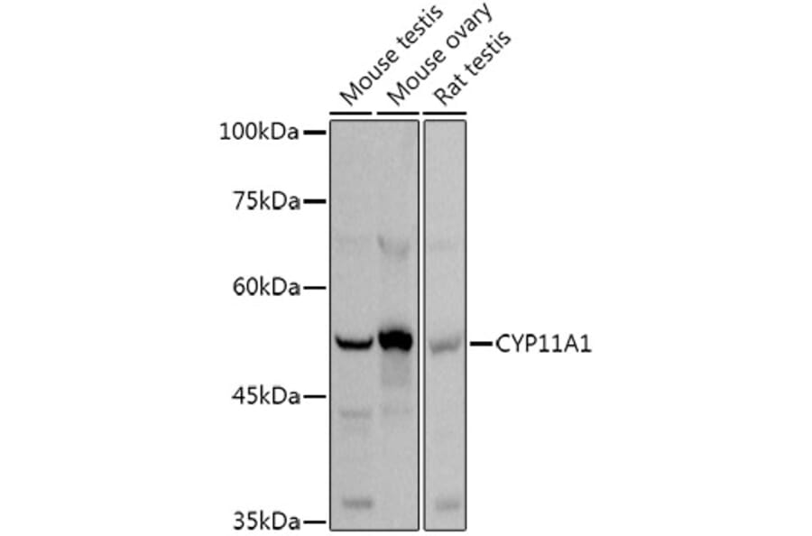 Western Blot - Anti-CYP11A1 Antibody (A13608) - Antibodies.com