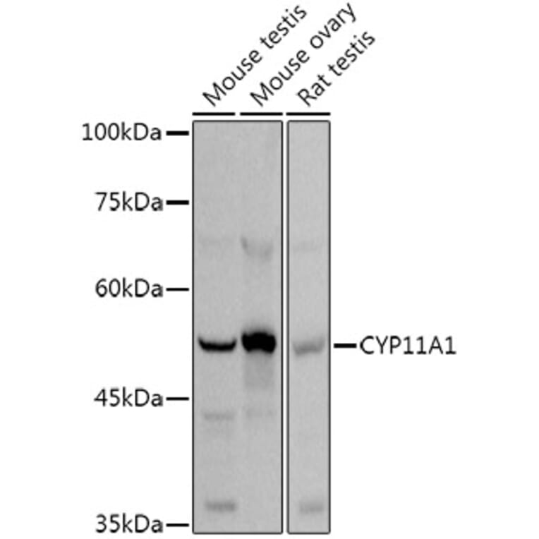 Western Blot - Anti-CYP11A1 Antibody (A13608) - Antibodies.com