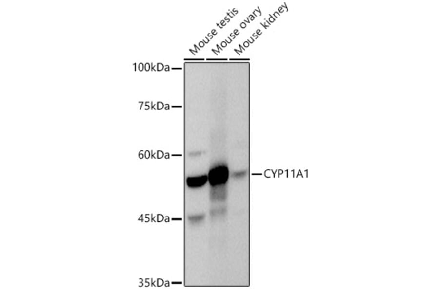 Western Blot - Anti-CYP11A1 Antibody (A13608) - Antibodies.com