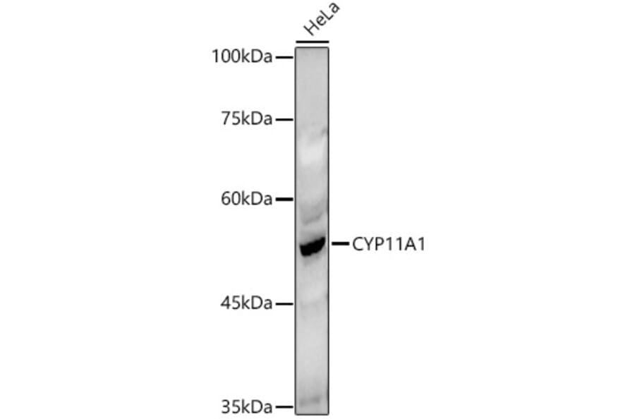 Western Blot - Anti-CYP11A1 Antibody (A13608) - Antibodies.com