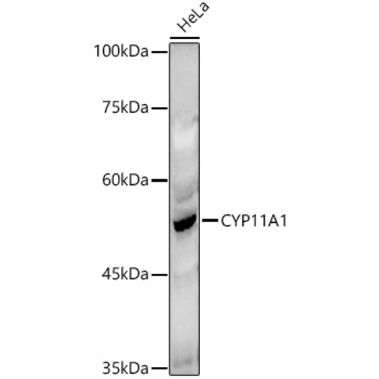 Western Blot - Anti-CYP11A1 Antibody (A13608) - Antibodies.com