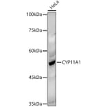 Western Blot - Anti-CYP11A1 Antibody (A13608) - Antibodies.com