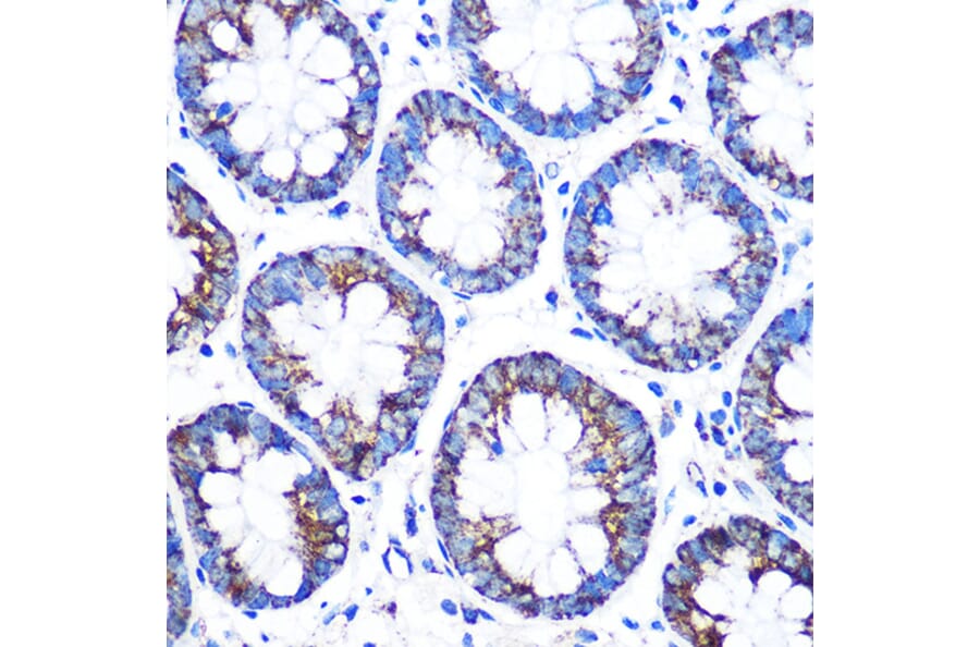 Immunohistochemistry - Anti-CYP11A1 Antibody (A13608) - Antibodies.com