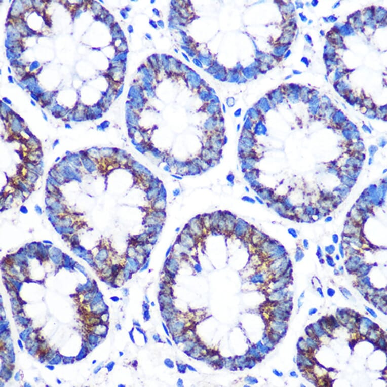 Immunohistochemistry - Anti-CYP11A1 Antibody (A13608) - Antibodies.com