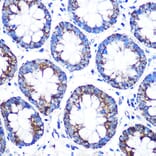 Immunohistochemistry - Anti-CYP11A1 Antibody (A13608) - Antibodies.com