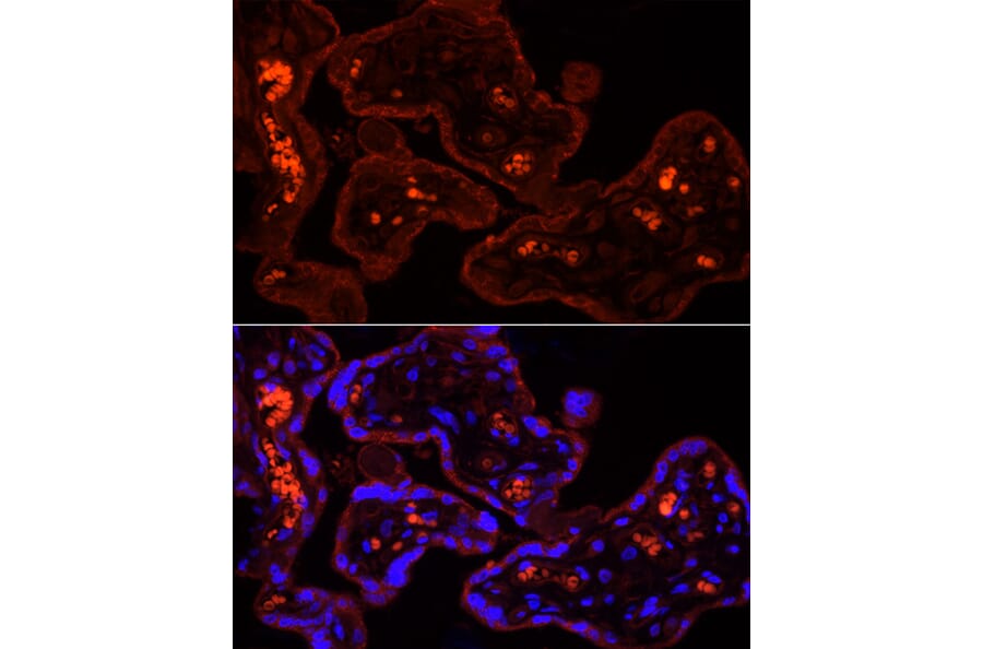 Immunofluorescence - Anti-CYP11A1 Antibody (A13608) - Antibodies.com