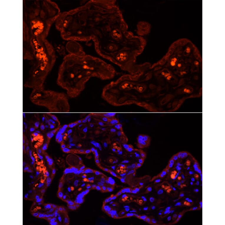 Immunofluorescence - Anti-CYP11A1 Antibody (A13608) - Antibodies.com