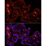 Immunofluorescence - Anti-CYP11A1 Antibody (A13608) - Antibodies.com