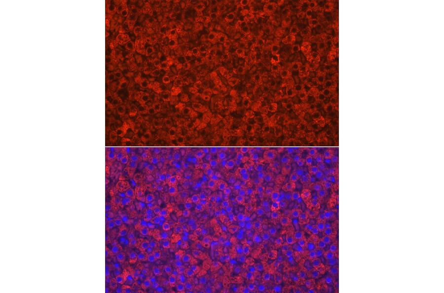 Immunofluorescence - Anti-CYP11A1 Antibody (A13608) - Antibodies.com