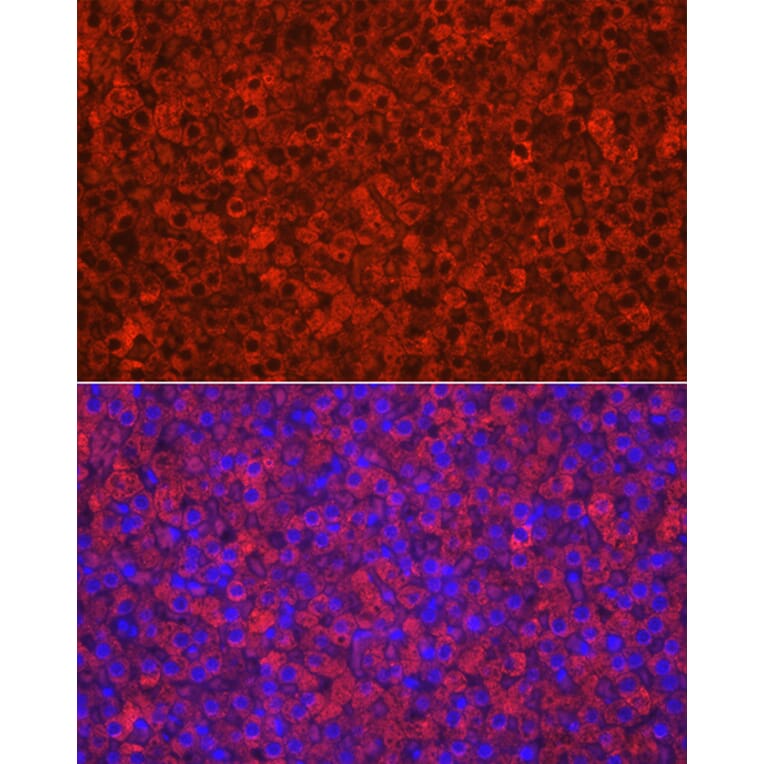 Immunofluorescence - Anti-CYP11A1 Antibody (A13608) - Antibodies.com