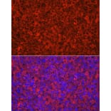 Immunofluorescence - Anti-CYP11A1 Antibody (A13608) - Antibodies.com