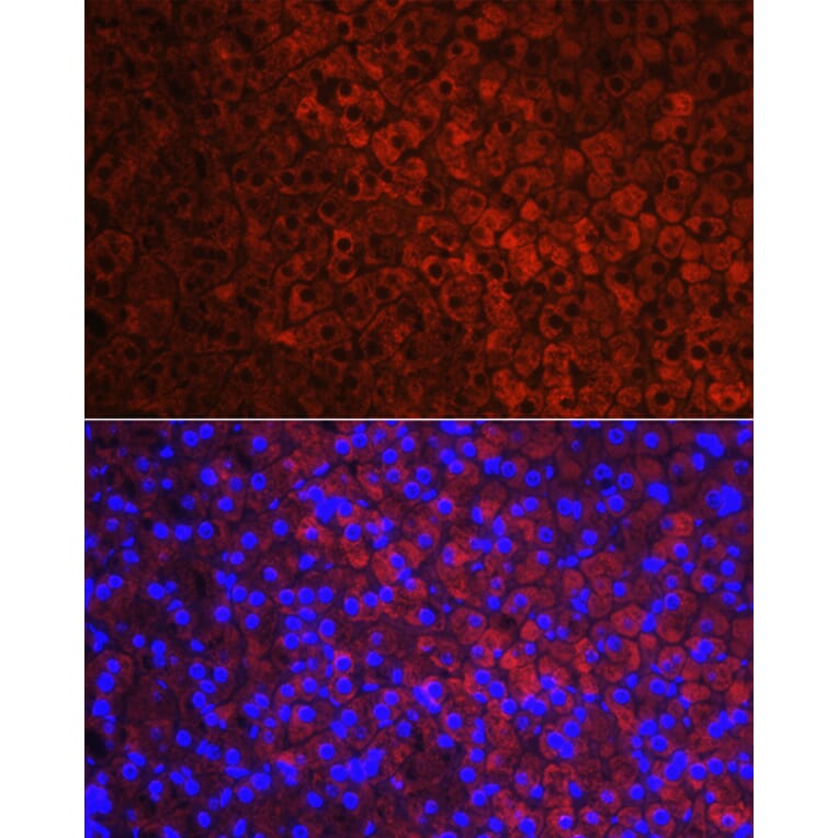 Immunofluorescence - Anti-CYP11A1 Antibody (A13608) - Antibodies.com