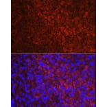 Immunofluorescence - Anti-CYP11A1 Antibody (A13608) - Antibodies.com