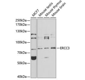 Western Blot - Anti-XPB Antibody (A13609) - Antibodies.com