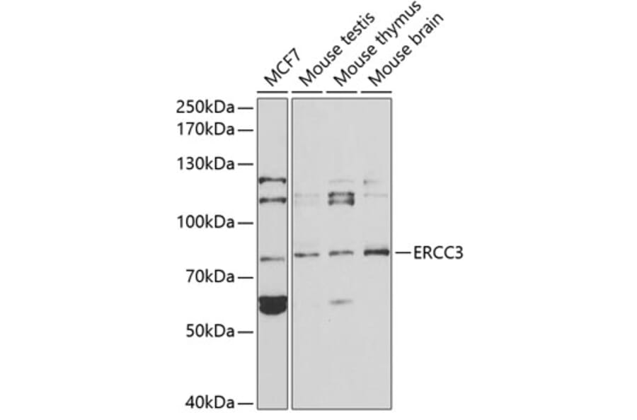 Western Blot - Anti-XPB Antibody (A13609) - Antibodies.com