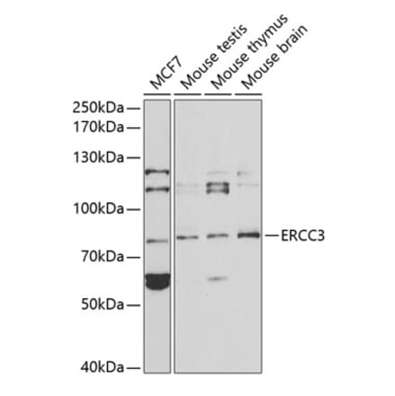 Western Blot - Anti-XPB Antibody (A13609) - Antibodies.com