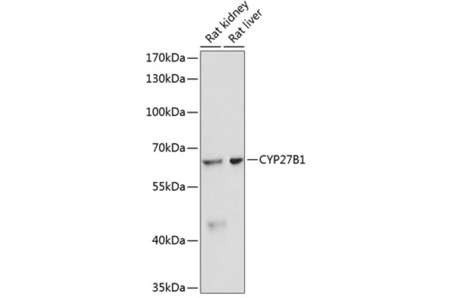 Western Blot - Anti-CYP27B1 Antibody (A13610) - Antibodies.com