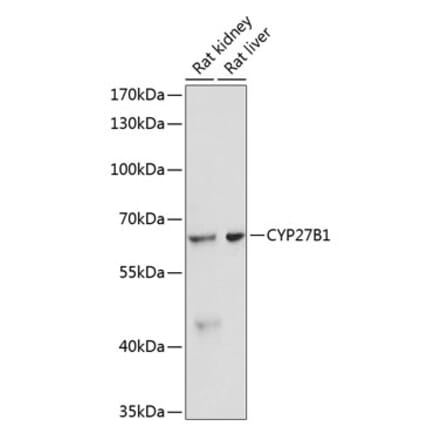 Western Blot - Anti-CYP27B1 Antibody (A13610) - Antibodies.com