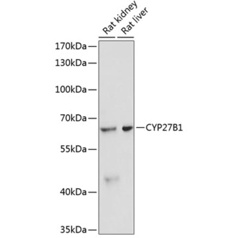 Western Blot - Anti-CYP27B1 Antibody (A13610) - Antibodies.com