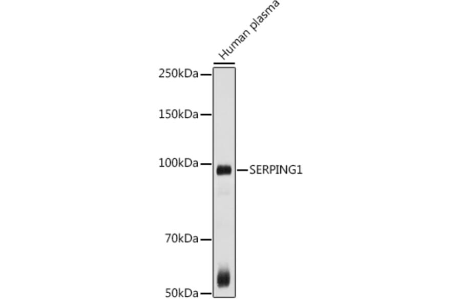 Western Blot - Anti-C1 inhibitor Antibody (A13611) - Antibodies.com