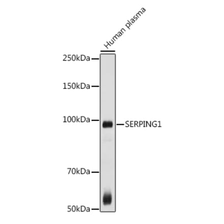 Western Blot - Anti-C1 inhibitor Antibody (A13611) - Antibodies.com