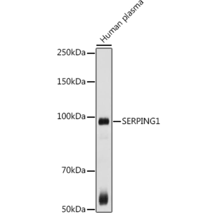 Western Blot - Anti-C1 inhibitor Antibody (A13611) - Antibodies.com