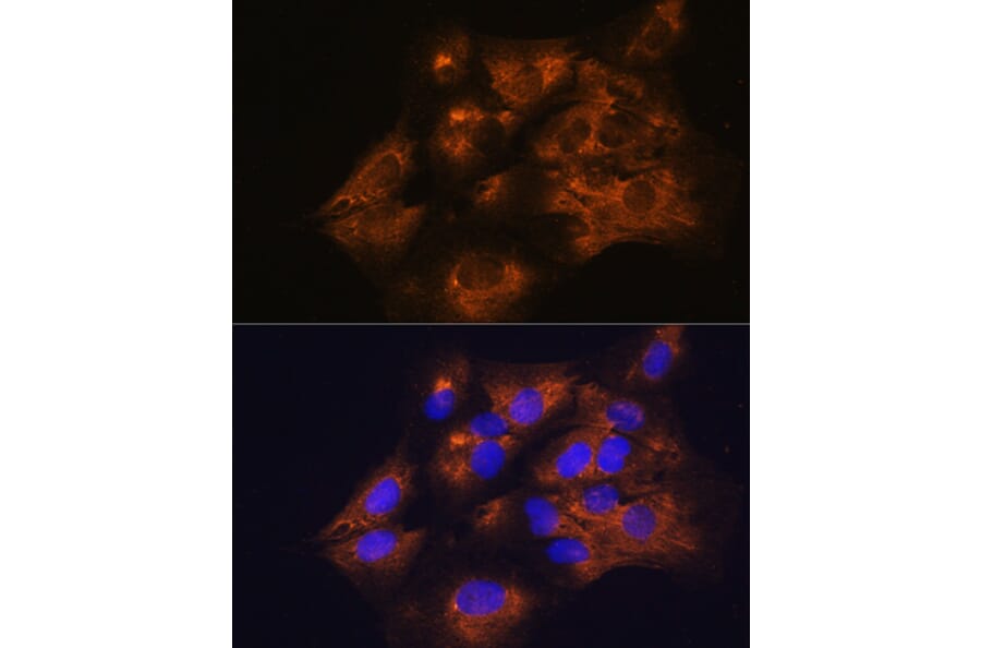 Immunofluorescence - Anti-C1 inhibitor Antibody (A13611) - Antibodies.com