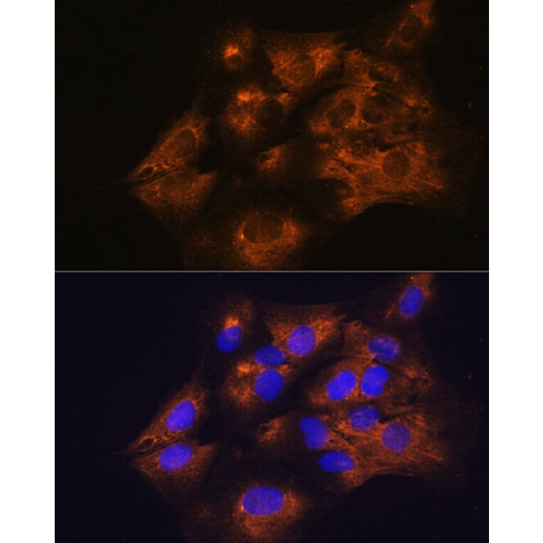 Immunofluorescence - Anti-C1 inhibitor Antibody (A13611) - Antibodies.com