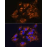 Immunofluorescence - Anti-C1 inhibitor Antibody (A13611) - Antibodies.com