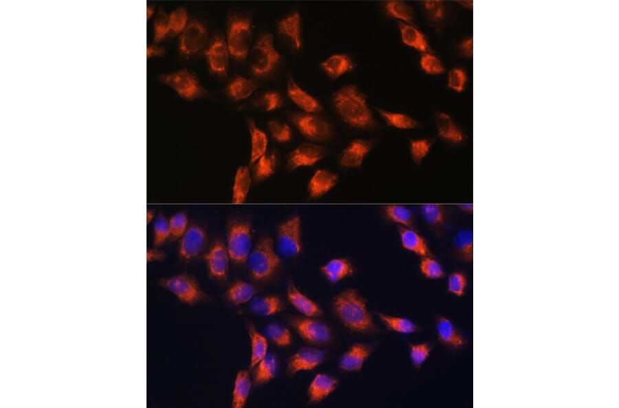 Immunofluorescence - Anti-C1 inhibitor Antibody (A13611) - Antibodies.com
