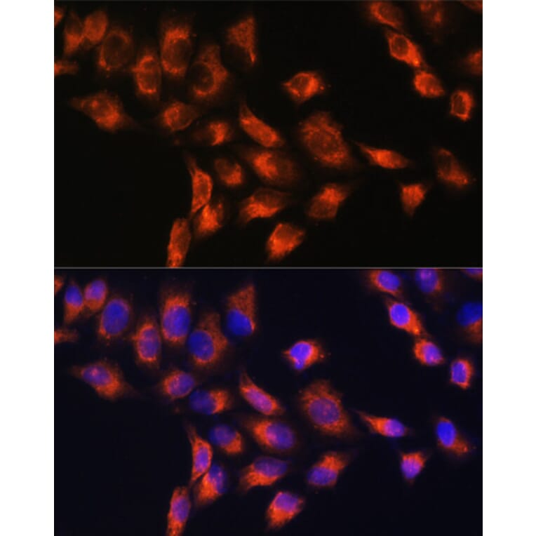 Immunofluorescence - Anti-C1 inhibitor Antibody (A13611) - Antibodies.com