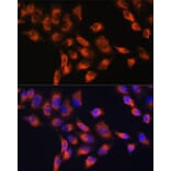 Immunofluorescence - Anti-C1 inhibitor Antibody (A13611) - Antibodies.com