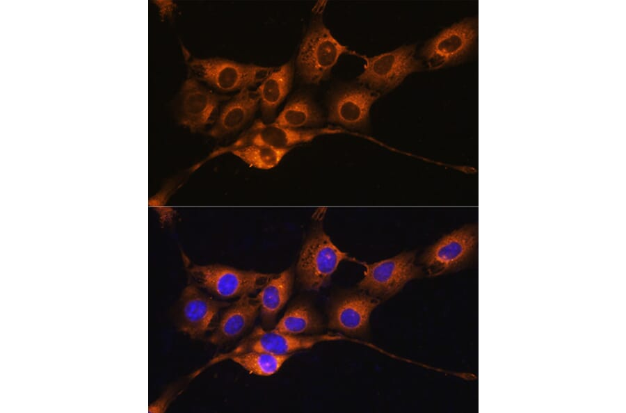 Immunofluorescence - Anti-C1 inhibitor Antibody (A13611) - Antibodies.com