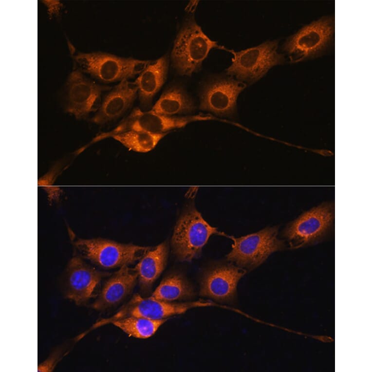 Immunofluorescence - Anti-C1 inhibitor Antibody (A13611) - Antibodies.com