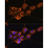 Immunofluorescence - Anti-C1 inhibitor Antibody (A13611) - Antibodies.com