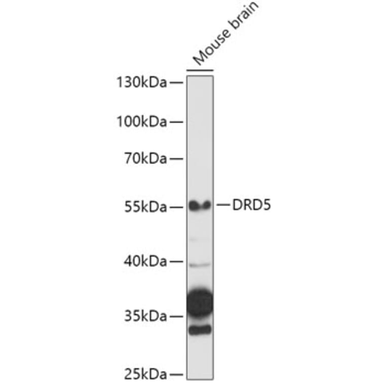 Western Blot - Anti-DRD5 Antibody (A13612) - Antibodies.com