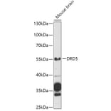 Western Blot - Anti-DRD5 Antibody (A13612) - Antibodies.com