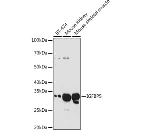 Western Blot - Anti-IGFBP5 Antibody (A13613) - Antibodies.com