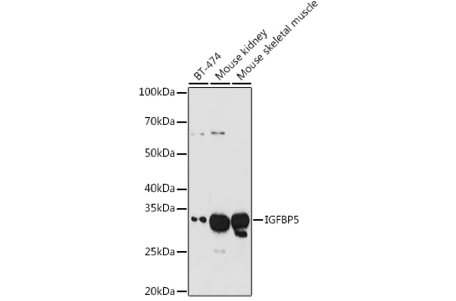 Western Blot - Anti-IGFBP5 Antibody (A13613) - Antibodies.com
