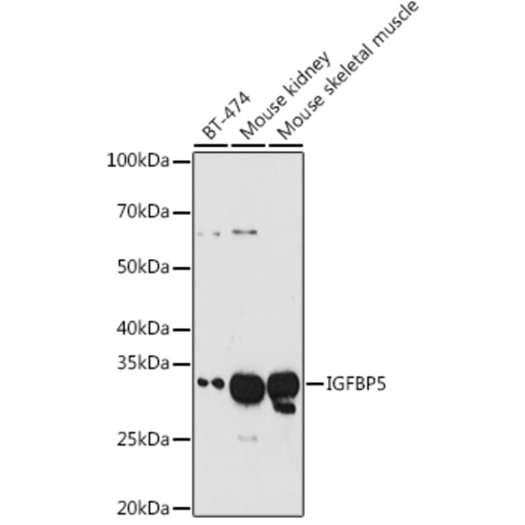 Western Blot - Anti-IGFBP5 Antibody (A13613) - Antibodies.com