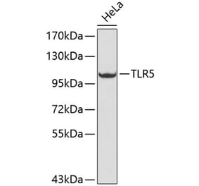 Western Blot - Anti-TLR5 Antibody (A13614) - Antibodies.com