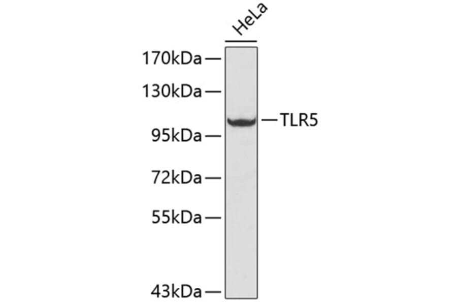 Western Blot - Anti-TLR5 Antibody (A13614) - Antibodies.com