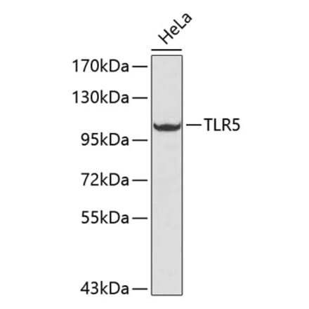 Western Blot - Anti-TLR5 Antibody (A13614) - Antibodies.com