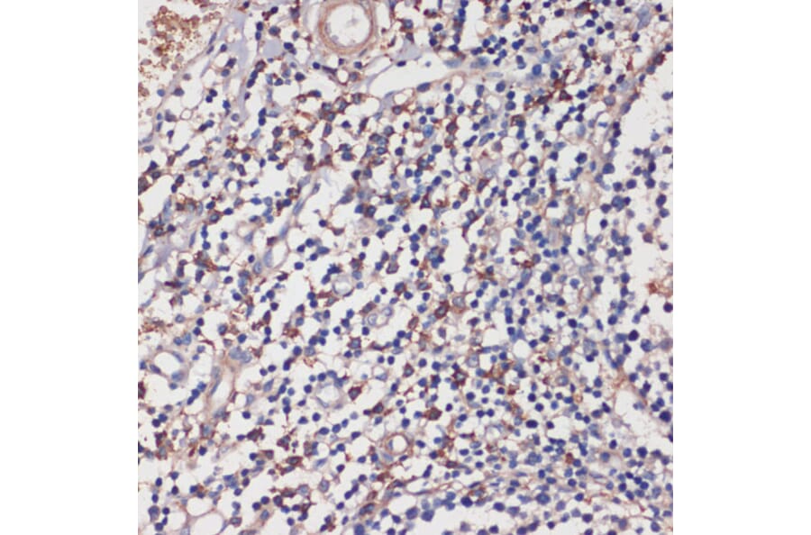 Immunohistochemistry - Anti-TLR5 Antibody (A13614) - Antibodies.com