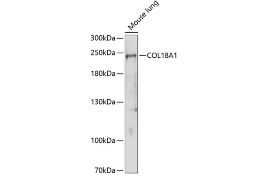 Western Blot - Anti-COL18A1 Antibody (A1722) - Antibodies.com