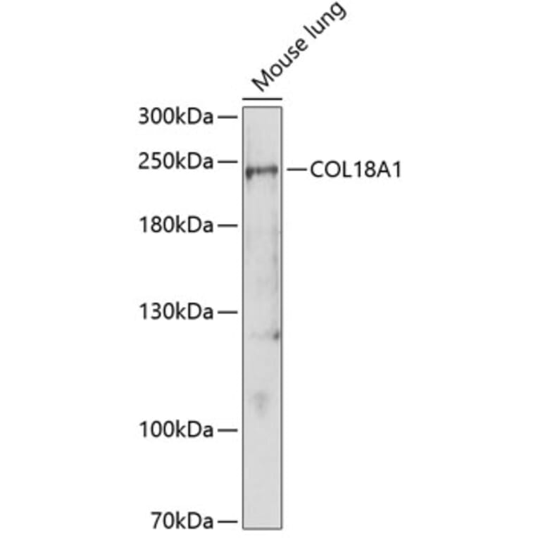 Western Blot - Anti-COL18A1 Antibody (A1722) - Antibodies.com