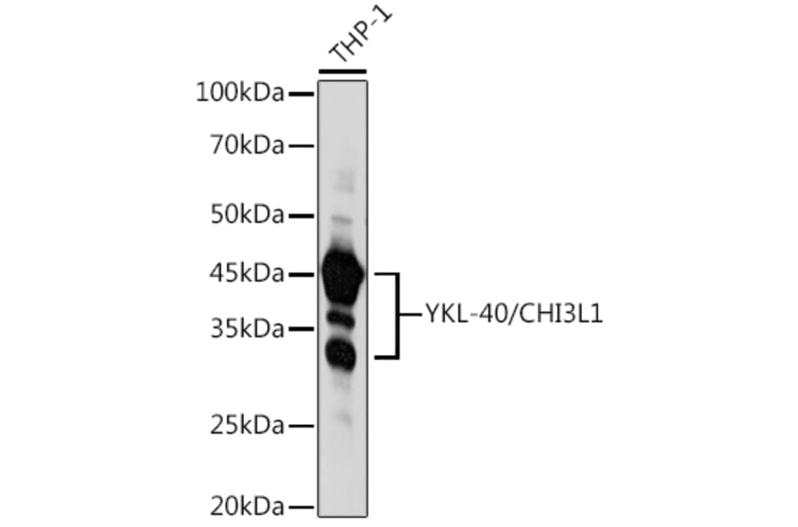 Western Blot - Anti-YKL-40/CHI3L1 Antibody (A13616) - Antibodies.com