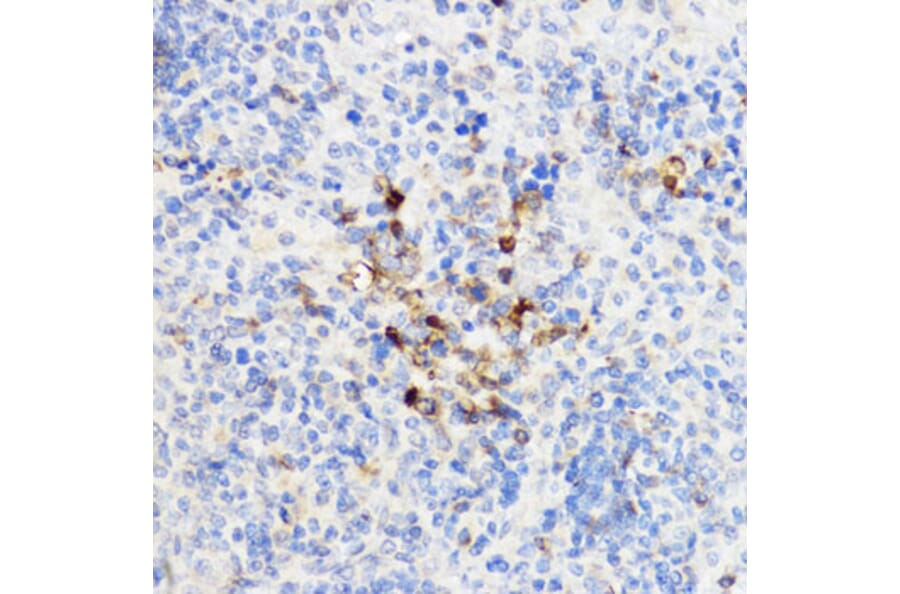 Immunohistochemistry - Anti-YKL-40/CHI3L1 Antibody (A13616) - Antibodies.com
